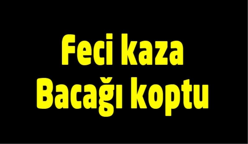 Feci kaza: Bacağı koptu