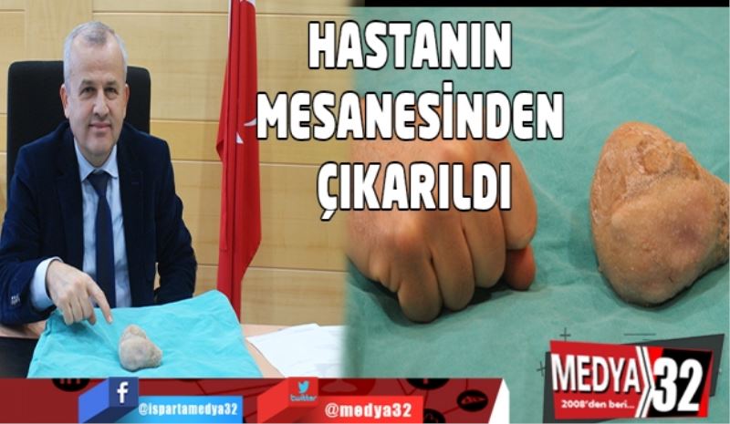 Hastanın mesanesinden dev taş çıkarıldı