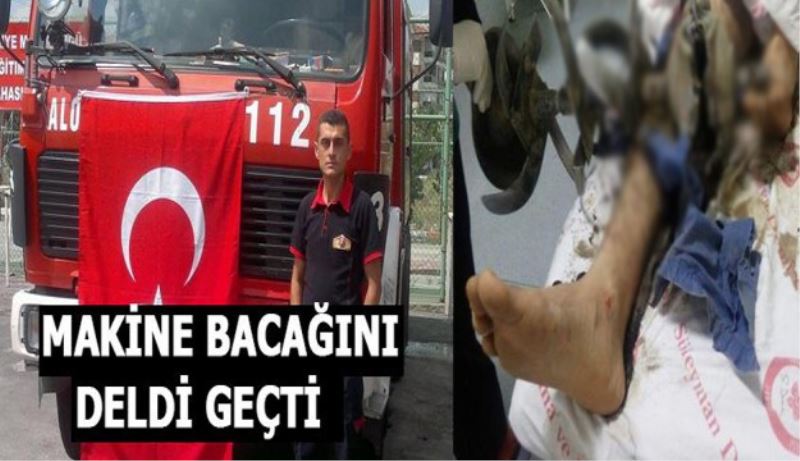 Makine bacağını deldi geçti