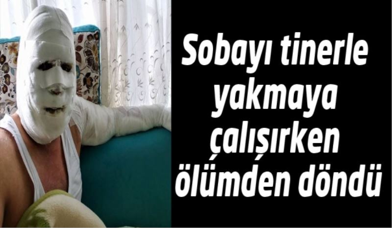 Sobayı tinerle yakmaya çalışırken ölümden döndü